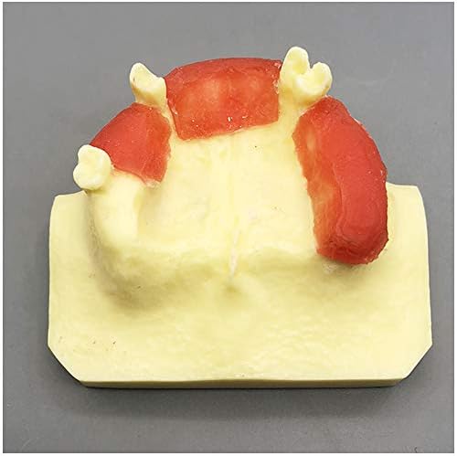 Modelo de implante dental KH66ZKY - Modelo de Estudo de Estudo de Lift de Liftação Dental -Sinusal - Osso simulado