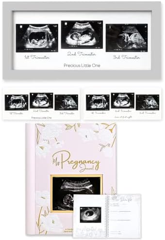 KeAbabies Sonogram Picture Frame and Gravidez Journal, Anúncios de gravidez - Trio Ultrassom Picture
