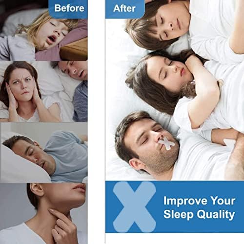 Patch Anti -Snoring, Tiras nasais Tiras para dormir dormindo adesivo nasal Salore fita adesiva