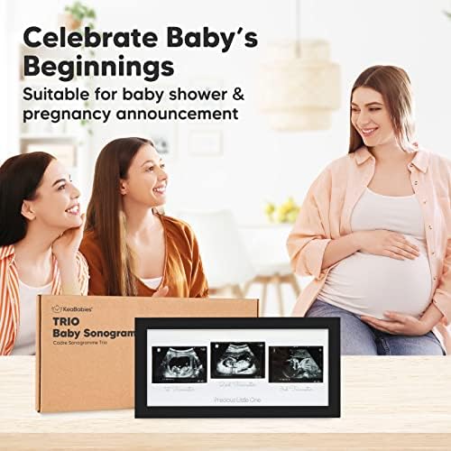 Sonograma Picture Frame - Trio Ultrassom Picture Frames for Mom Be Gift - Baby Ultrassom Frame - Anúncios de gravidez Sonogram