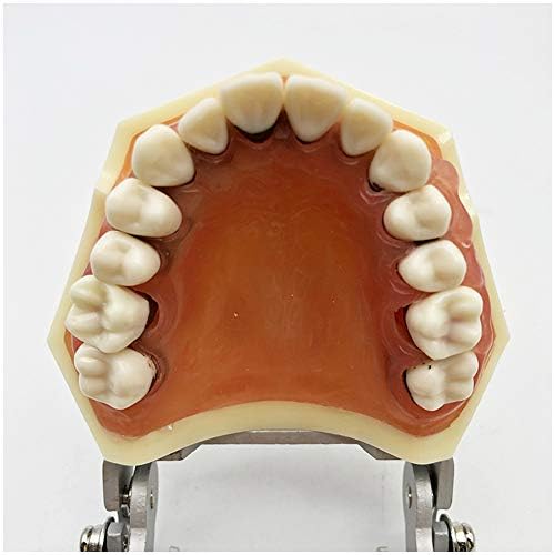 KH66ZKY Patologia periodontal de cálculo dental Modelo de patologia dental dentes Modelo Removável