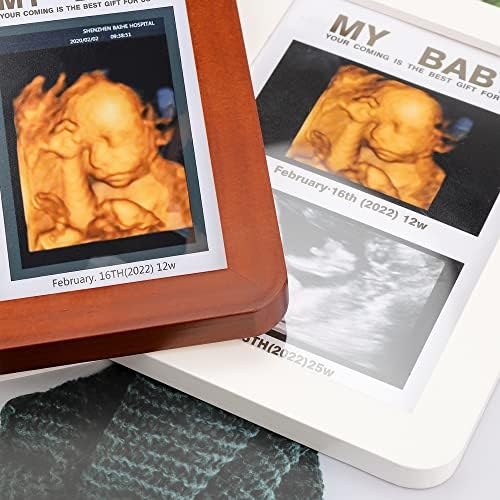 Baby Sonograma Picture Picture Frame Ultrassom Photo Frame Anúncio de gravidez Sonogram